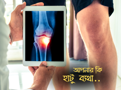 kNEE PAIN slide
